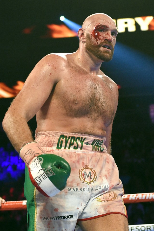  Fury's eye looked gruesome at the final bell
