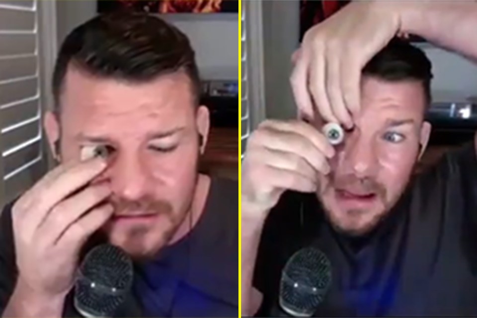 Bisping pulled his prosthetic eye out of his skull while filming his podcast back in 2019