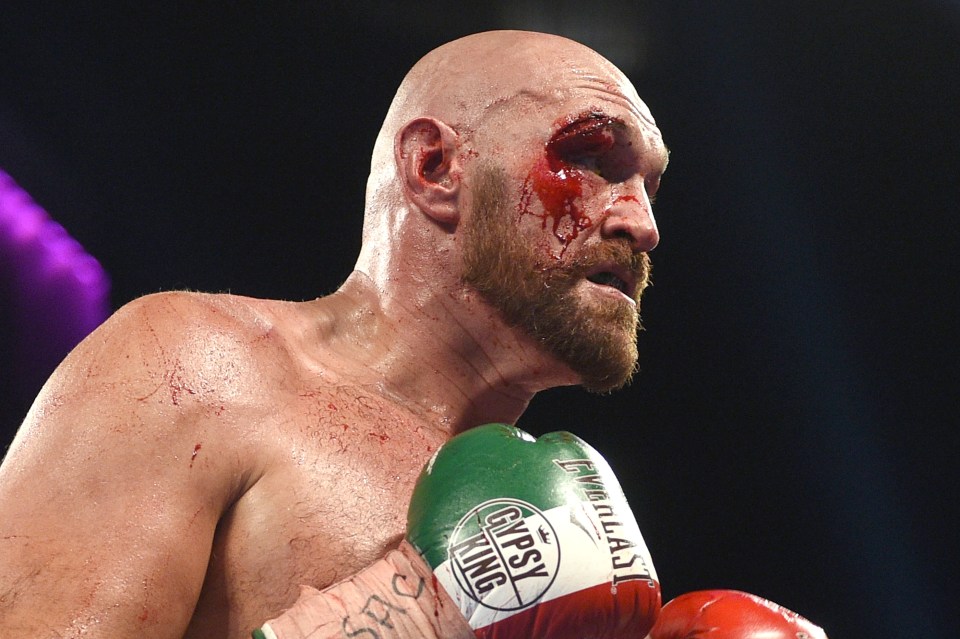Fury required multiple stitches after he suffered a cut above his right eye during his fight with Otto Wallin