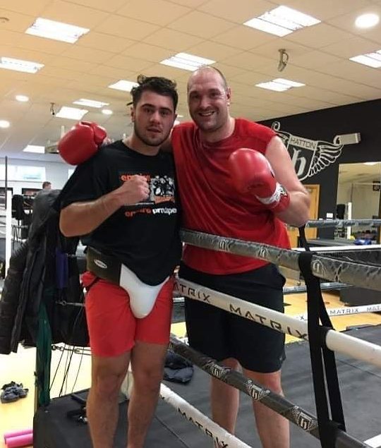 Allen and Fury have sparred several times in the past, and Allen was beaten by Whyte back in 2016
