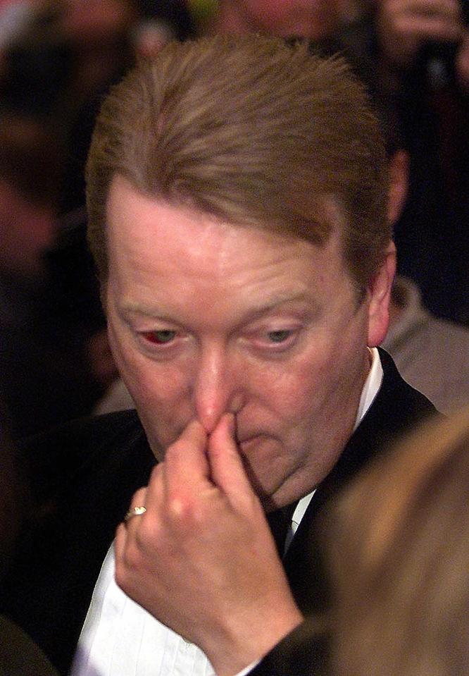 Warren's bloodied eye was visible when he attended the fight a few days after the altercation