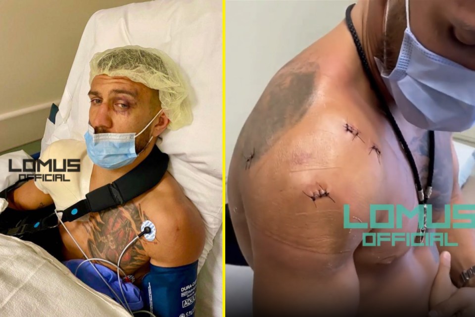  Lomachenko was injured before the fight