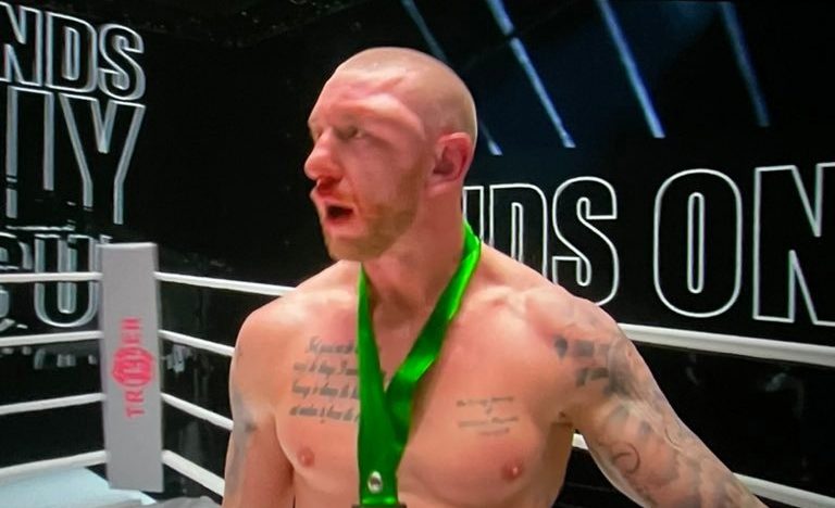  Blake McKernan was left with a nasty hematoma on the side of his face after his defeat to Badou Jack