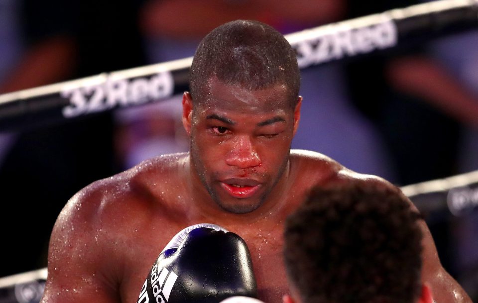  Dubois was badly injured as he was defeated by Joyce