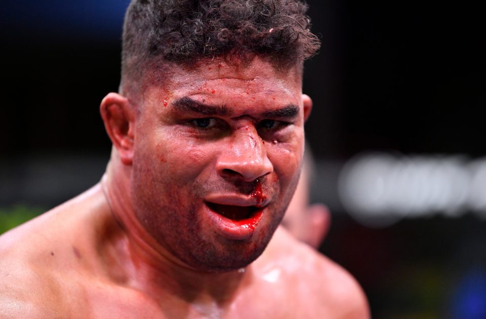 Overeem was a big star in UFC