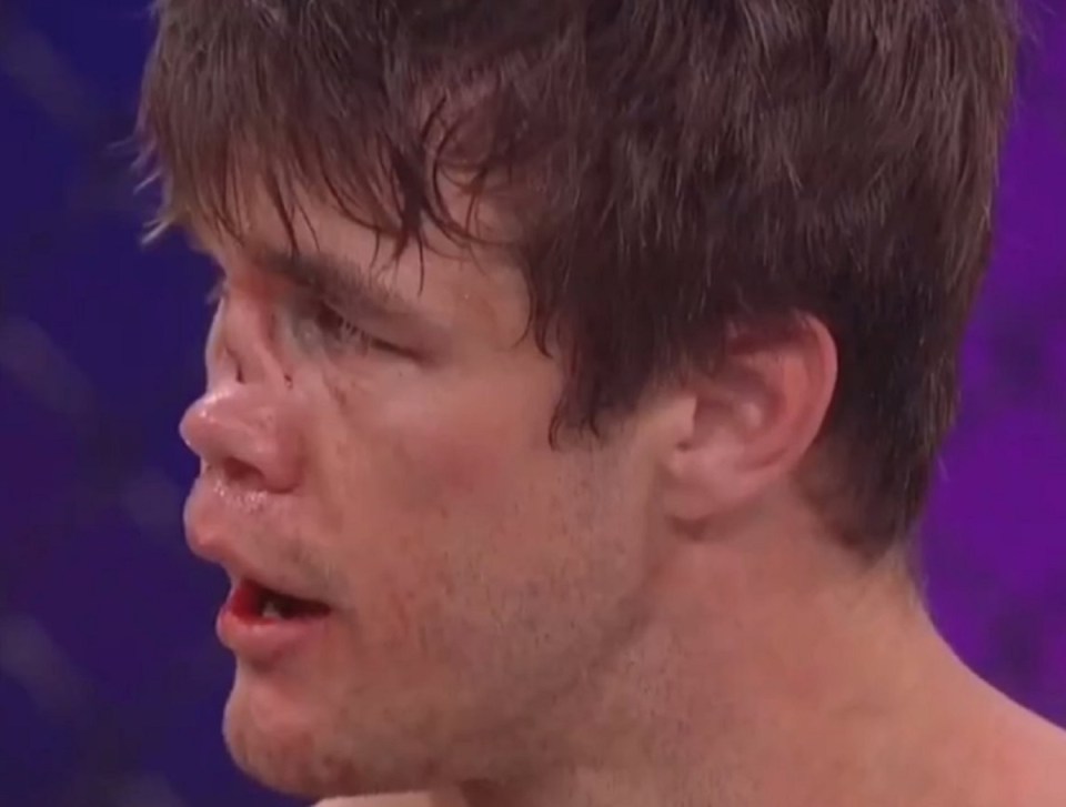 That's as bad a break as he could have had