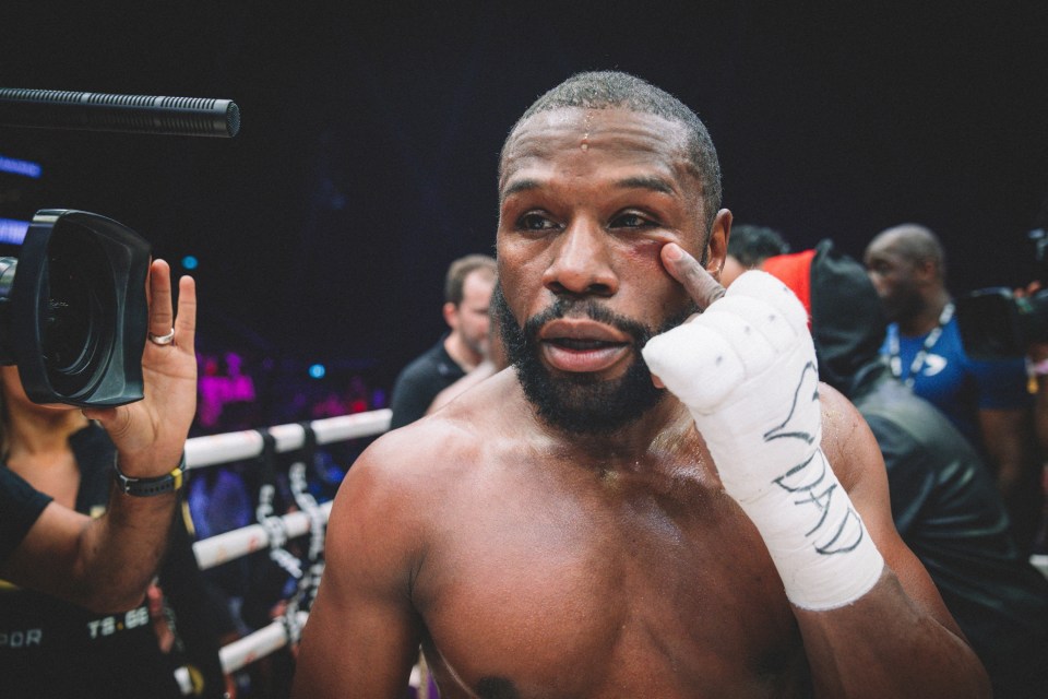 The boxing legend was left with a black eye that went viral though