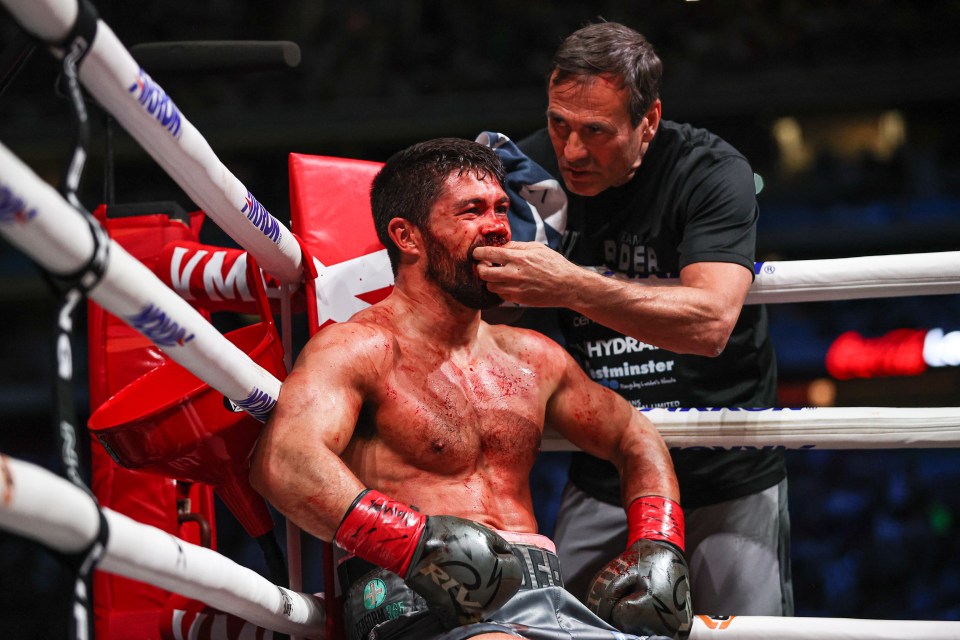 Ryder had his nose broken in the early rounds against Canelo but showed his durability