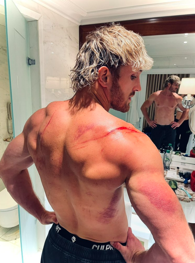 Paul didn't escape without injury