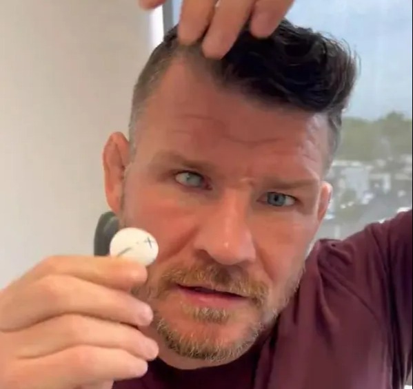 Michael Bisping's party trick is pulling out his prosthetic eye