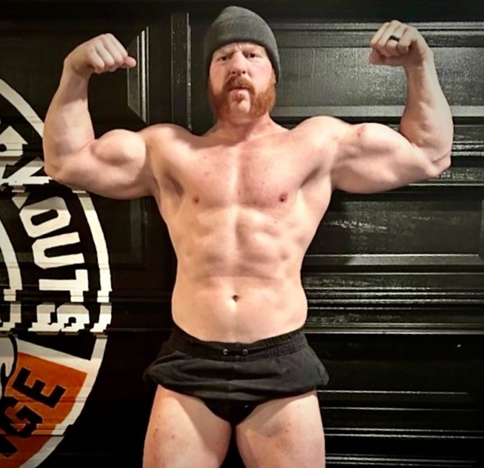 Sheamus will soon be back in top shape