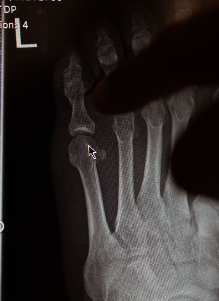 He even shared a photo of his X-ray