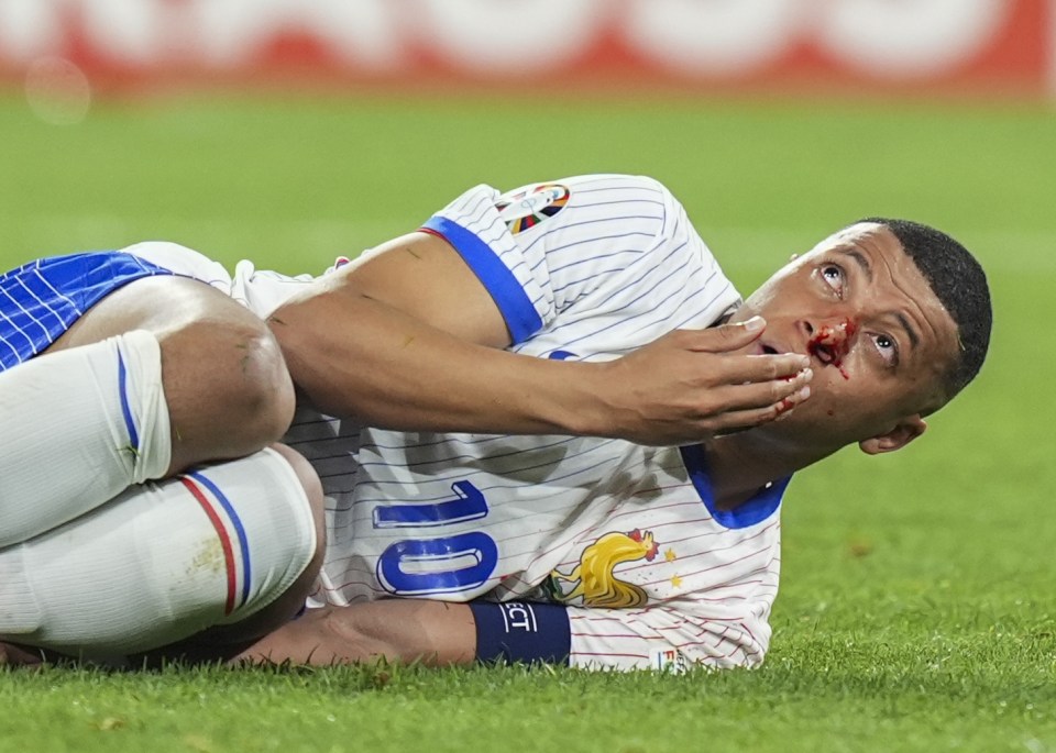 Mbappe was left in a world of pain