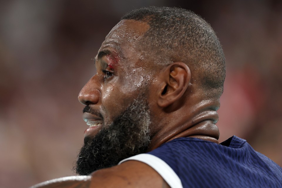 James' left eye was left bloody after suffering a nasty injury during the win over Brazil