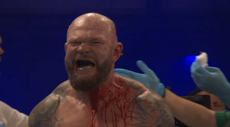 Darch's ear was in a terrible state after the contest