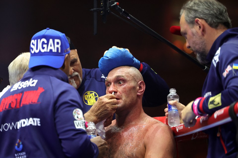 Fury had a number of voices in his corner when losing to Usyk