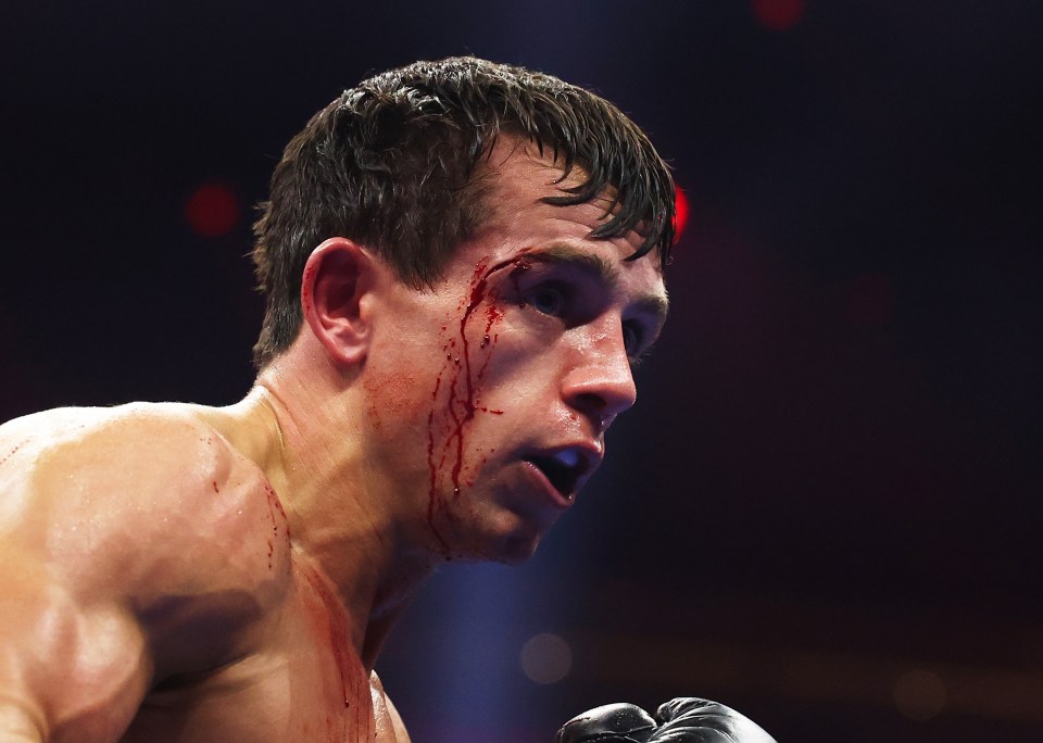 RIYADH, SAUDI ARABIA - DECEMBER 21: (EDITORS NOTE: Image contains graphic content.) Peter McGrail looks on with a cut during the Featherweight fight between Peter McGrail and Rhys Edwards as part of Oleksandr Usyk v Tyson Fury 2, Reignited card at Kingdom Arena on December 21, 2024 in Riyadh, Saudi Arabia. (Photo by Richard Pelham/Getty Images)