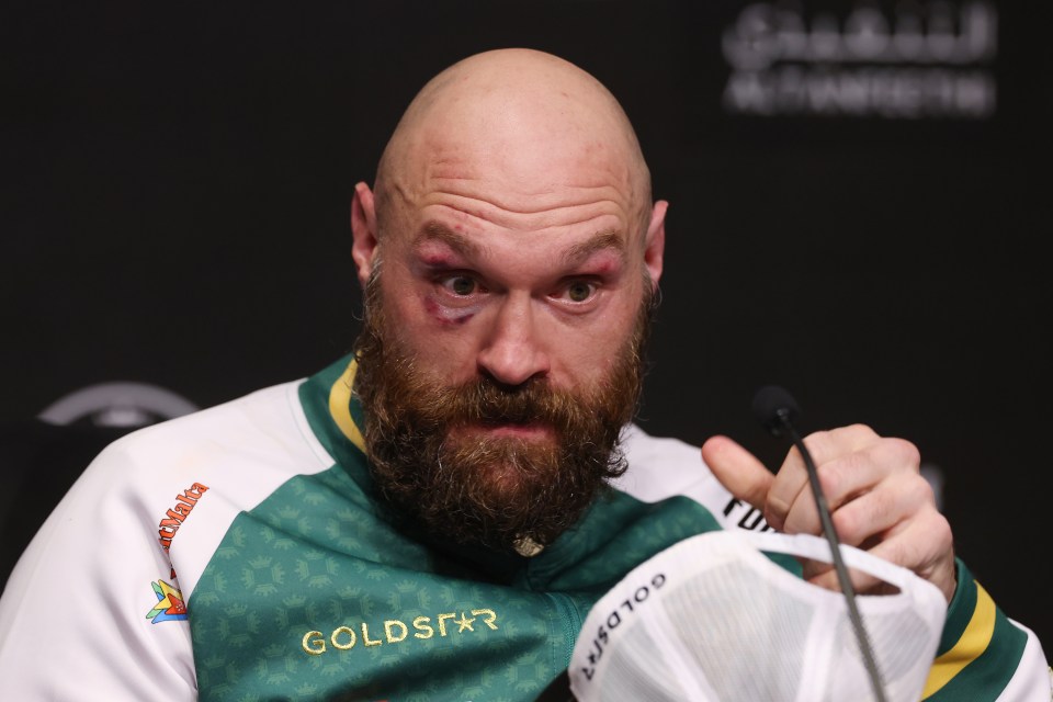 Fury has retired from boxing but could be lured back in at any point