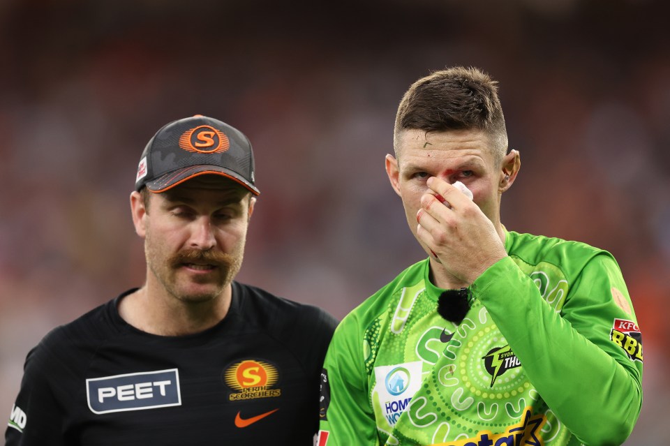 Ten-cap Test international Bancroft walked off the pitch with a bloody nose