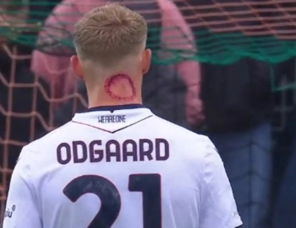 The Bologna star got fans talking with the red ring on his neck