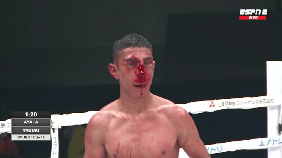 Ayala's face was also painted red by a cut above his right eye