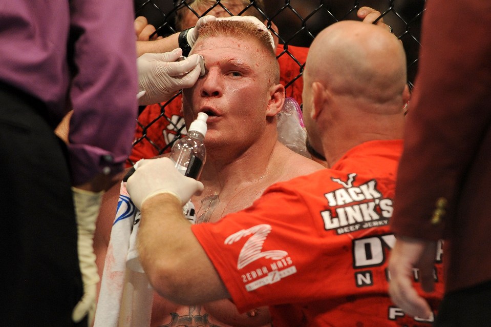 Lesnar looked battered after the first five minutes