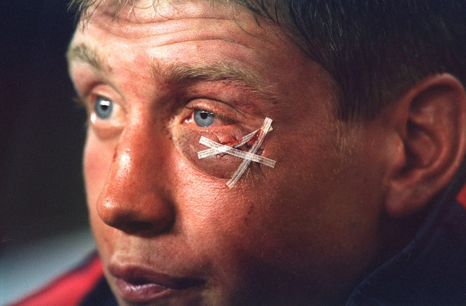 O'Gara's war wounds from the shocking incident were clear to see in the game's aftermath
